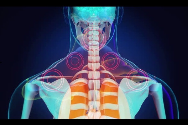 Upper Cervical Chiropractic at Victory Spinal Care